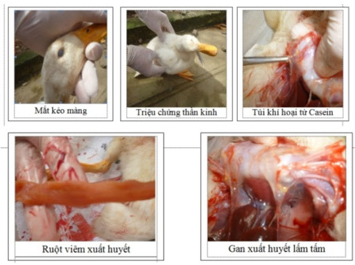 Bệnh nhiễm khuẩn E.COLI